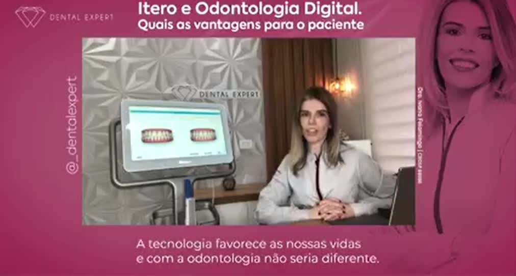 Registro do vídeo de iTero publicado pela Dental Expert, apresentado pela Dra. Ivana Felamingo