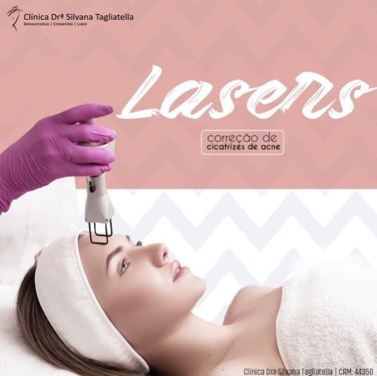 Lasers: correção de cicatrizes de acne